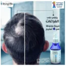 سترونج فيل سبراى هير لوشن