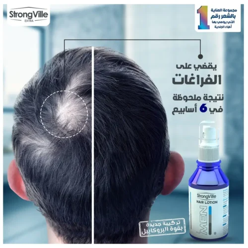 سترونج فيل سبراى هير لوشن