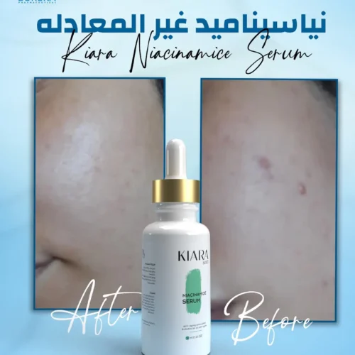 كيارا نياسيناميد اخضر